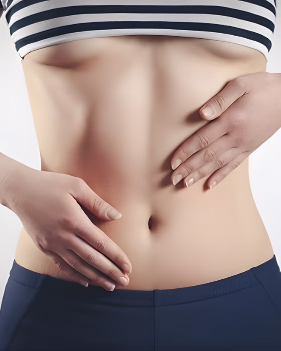 Abdominoplastia en Bucaramanga