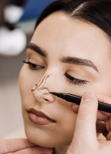 Rinoplastia estética y funcional en Bucaramanga por la Dra. Olga Cuello