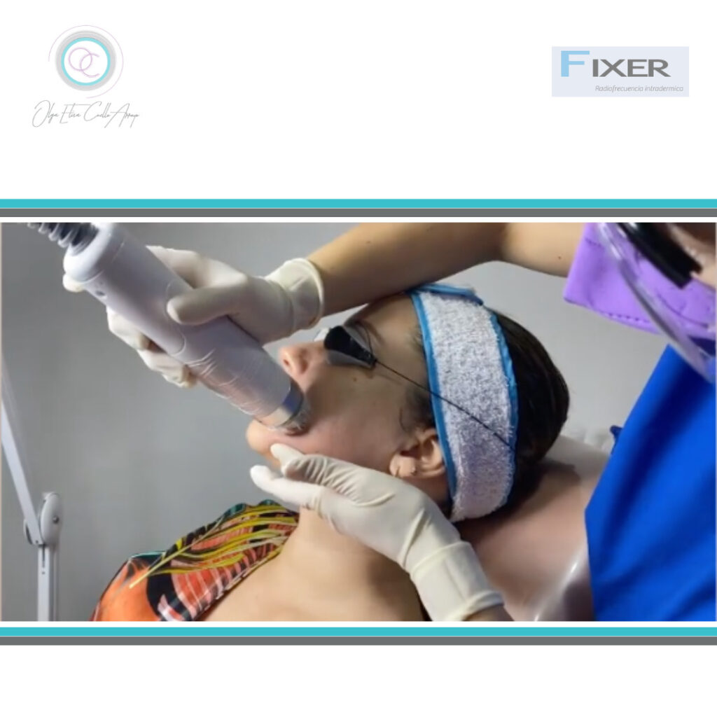 Fixer Tecnología de punta Dra Olga Elisa Cuello Arroyo Cirugía Plástica Bucaramanga Colombia